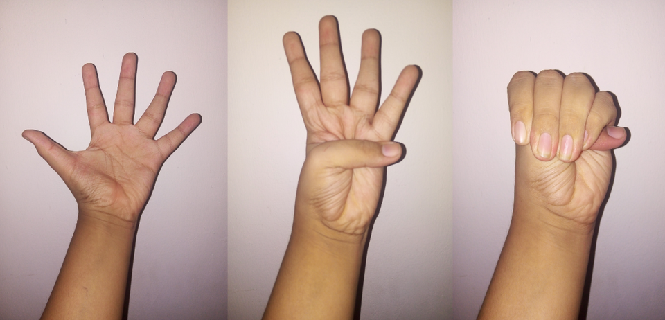 Three photographs show an open hand, the thumb drawn across the palm, and a closed fist with the distal thumb projecting past the ulnar edge.