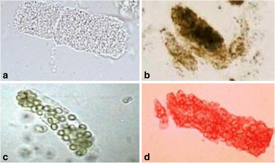 Published urine microscopy panels: A renal tubular epithelial cell cast, B muddy brown granular cast, C white blood cell cast, and D red blood cell cast.