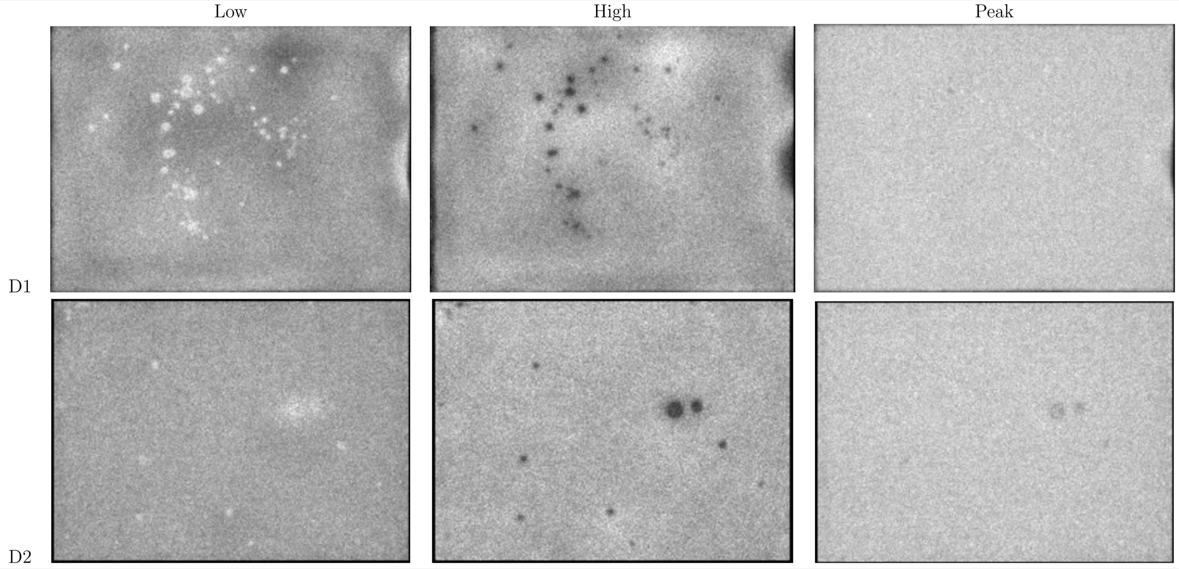 Two gamma camera detector uniformity images acquired below, above and at the correct photopeak
