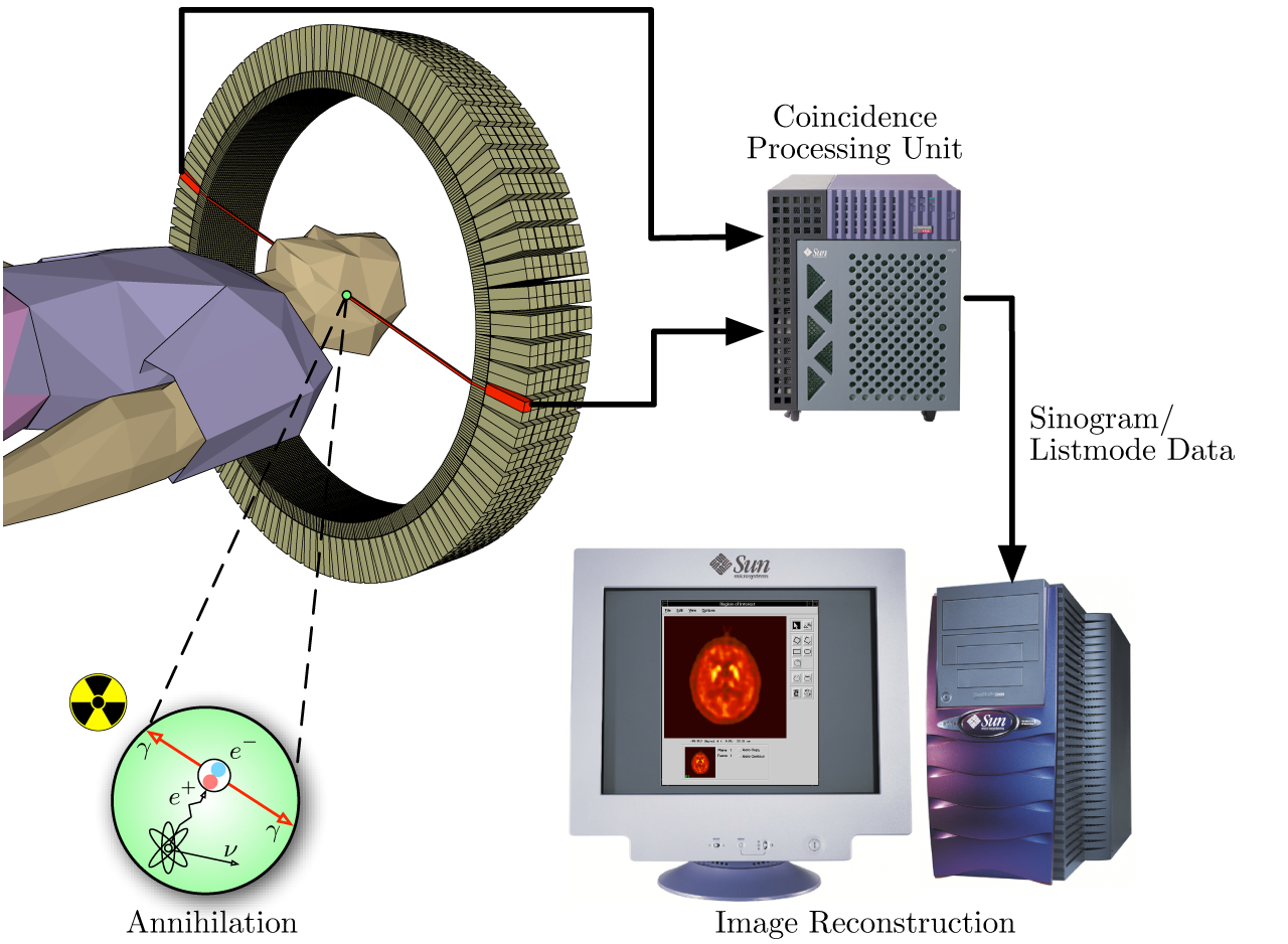 PET annihilation, detector ring, line of response and image reconstruction schematic