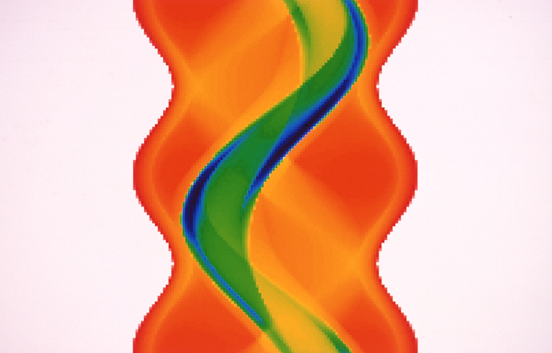 SPECT sinogram showing projection data across detector angles