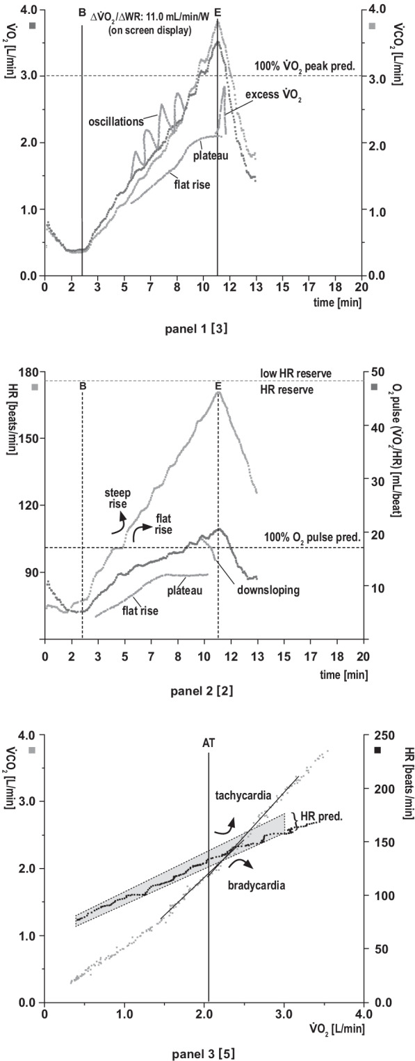 Published CPET cardiovascular panels showing oxygen uptake and carbon dioxide output, heart rate and oxygen pulse, and V-slope patterns
